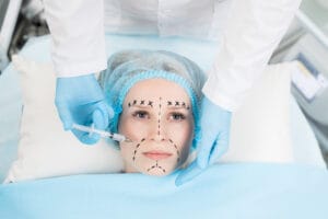 Young woman with highlighter marks on her face having anti-wrinkle injection in area between nose and lips